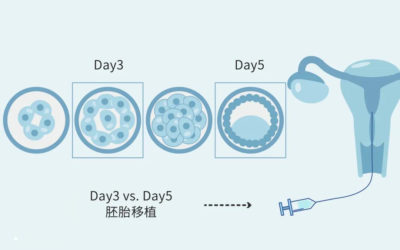 冷冻胚胎移植的好处有哪些？